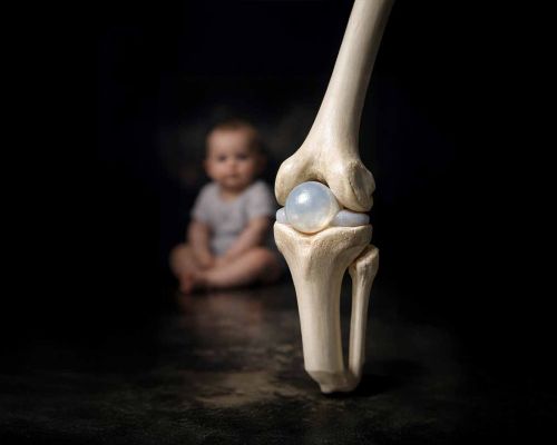 Çocuklar Diz Kapağı Olmadan Doğar: Kemikleşme Süreci Yıllar İçinde Tamamlanıyor