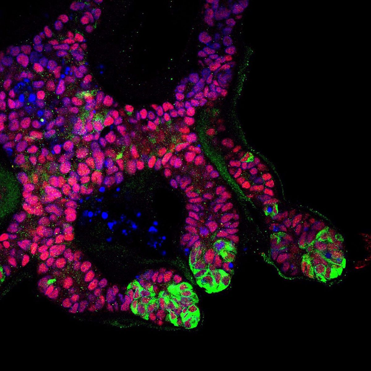 human-kidney-ureteric-bud-organoids-1536x1536