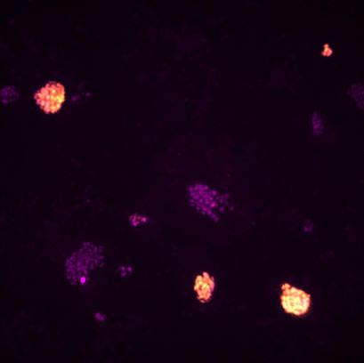 reprogrammed-pluripotent-stem-cells